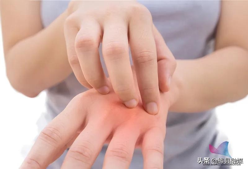河南辉县丨为什么一到冬天就浑身瘙痒？别挠！缓解办法拿走不谢辉县市融媒体中心
