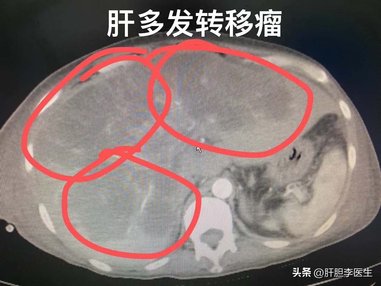 胃疼半年了后背也疼怎么回事,胃疼了半个月了吃了药也不好