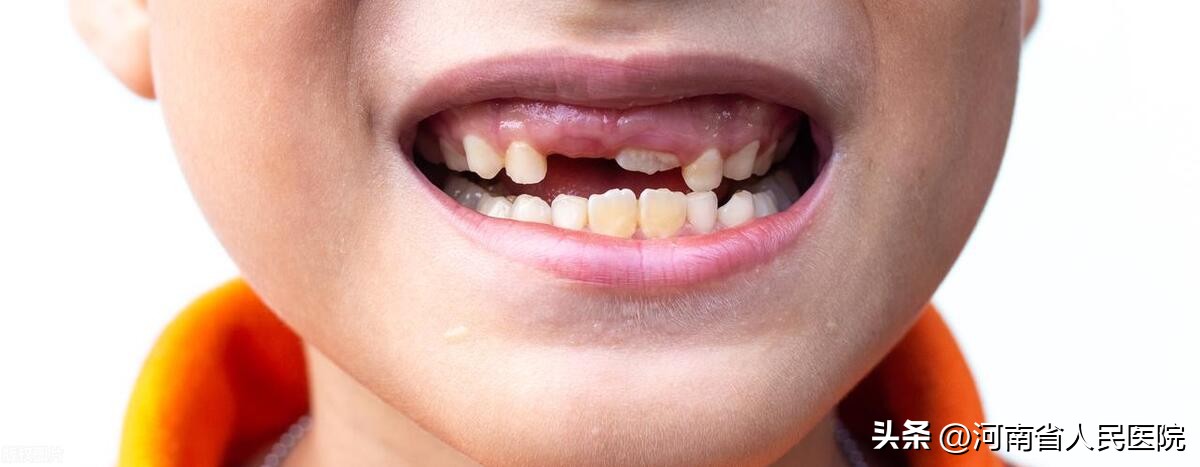 口腔看牙真的能做到全程无痛吗,牙齿麻醉有几种方式