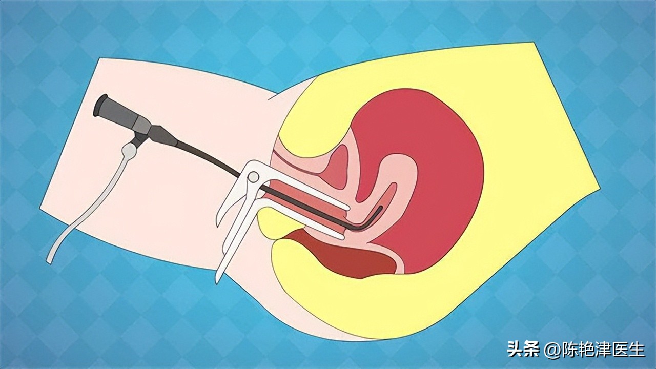 女性为什么容易长子宫肌瘤？提醒：平时尽量避免3个行为，别忽视