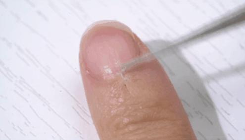 手指长倒刺缺乏哪种维生素,宝宝手指倒刺是缺什么维生素