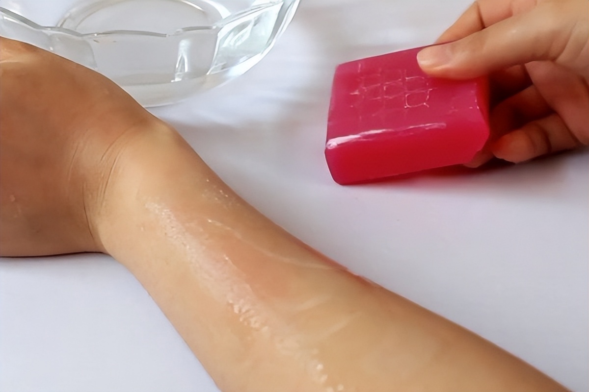 被蚊子咬快速止痒小妙招,蚊子咬的痒吃什么药止痒