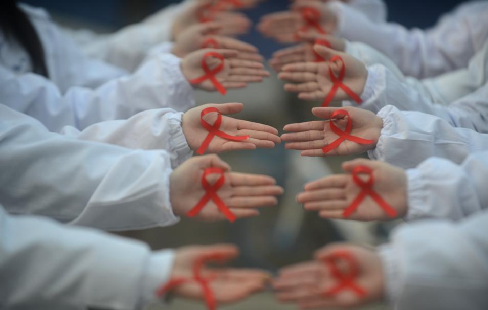 艾滋病别误以为是皮肤病,不要把艾滋病当成皮肤病