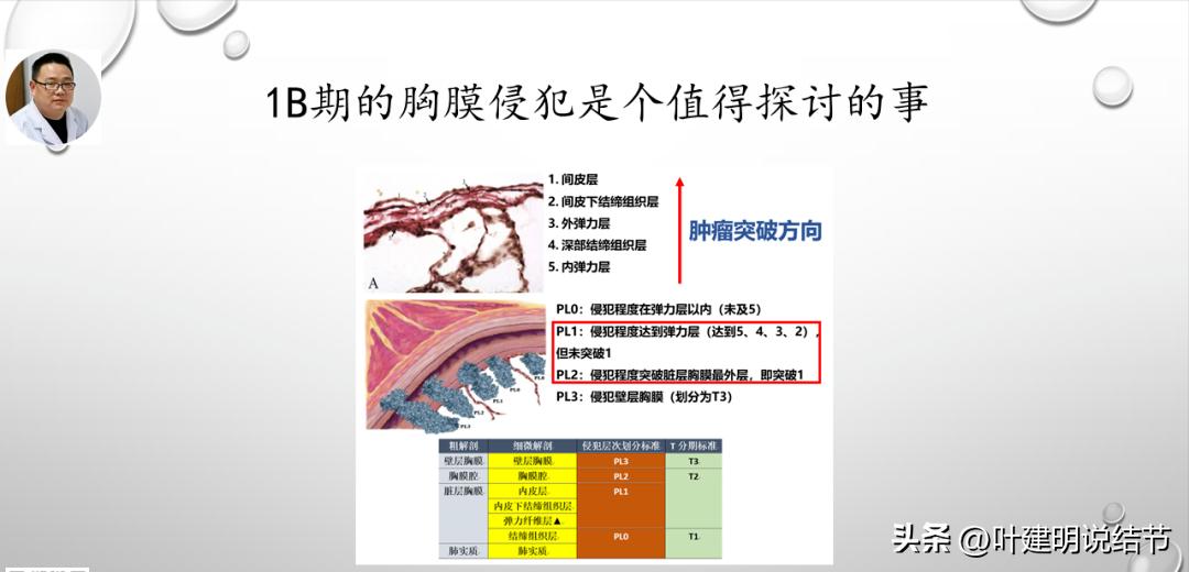 非小细胞肺癌精准检测ppt,关于肺癌的ppt