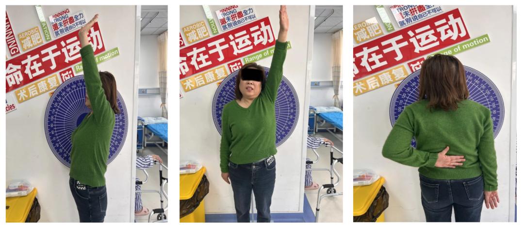 肩关节疼痛的康复训练方法,肩关节前侧疼痛康复训练