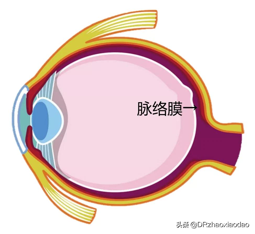 脉络膜增厚怎么解决,脉络膜增厚会怎么样