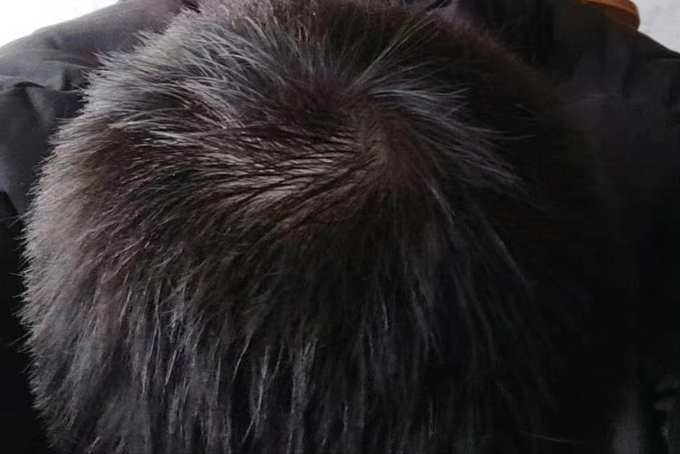 米诺地尔多久长头发,用米诺地尔三个月真可以长出头发