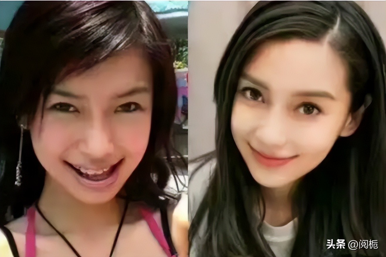 靠换脸逆天改命的六位女星,长得歪瓜裂枣整得美若天仙的明星