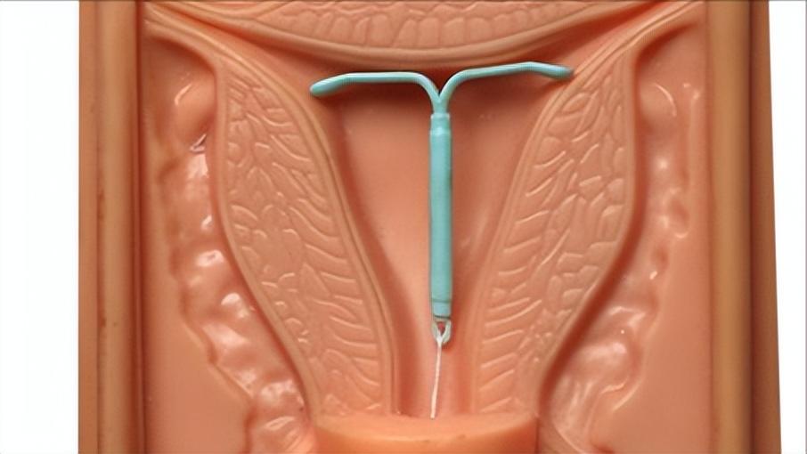药流伤害大还是紧急避孕药伤害大,药流安全还是手术流产安全