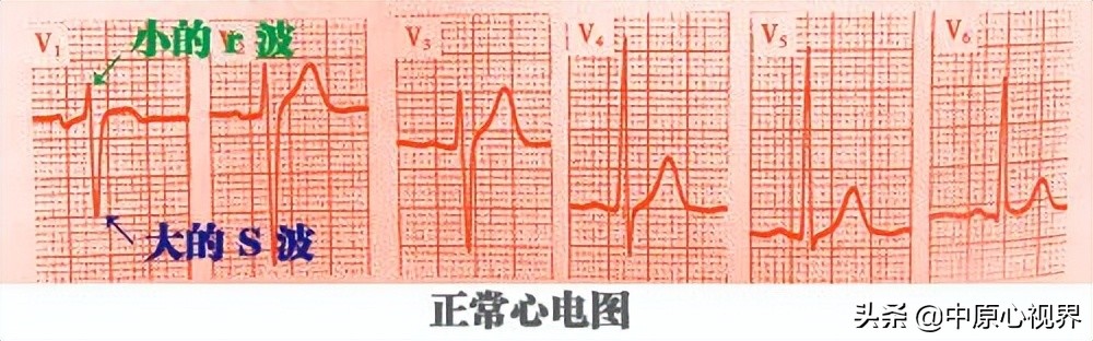 护考几种常见的心电图,常见的心电图图形分析
