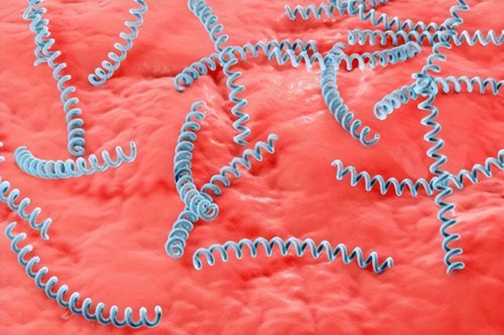 梅毒初期是什么症状梅毒怎么治,得了梅毒会有什么症状