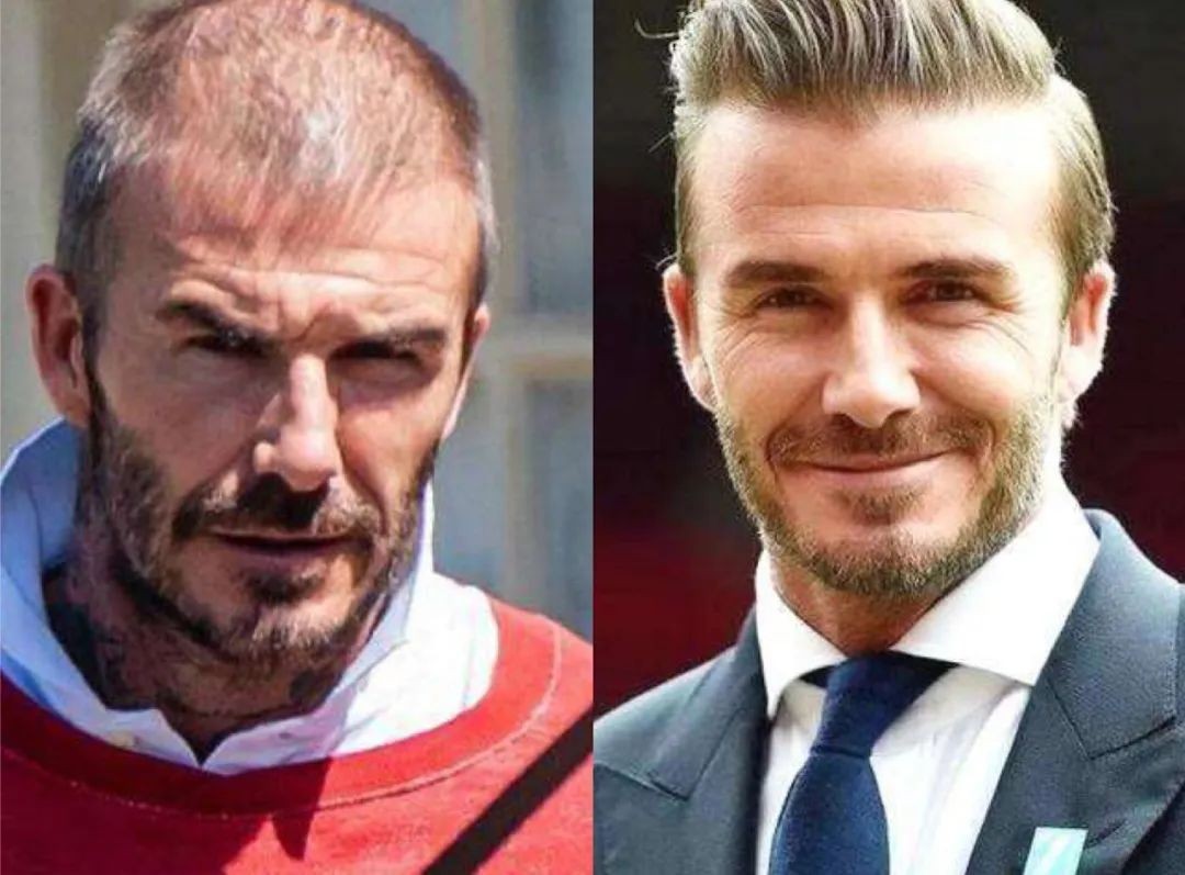 井水和水垢怎么去除,井水的水垢怎么去除最快