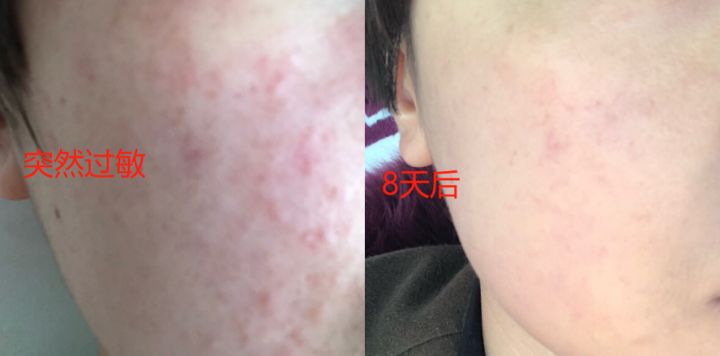 孕妇孕期护肤误区大揭秘,孕妇用的护肤品哪个最坑