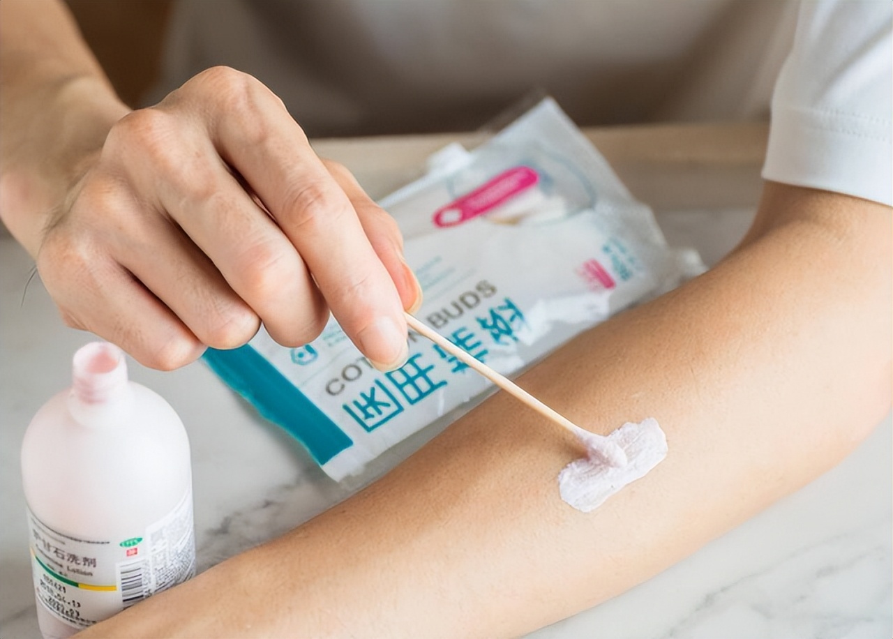 炉甘石洗剂的作用和功效价格,炉甘石洗剂的功效与作用和价格