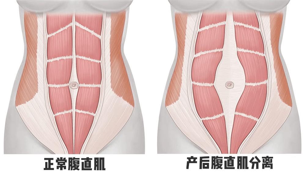如果不避孕一辈子能生几胎,如果不备孕女子能生多少孩子