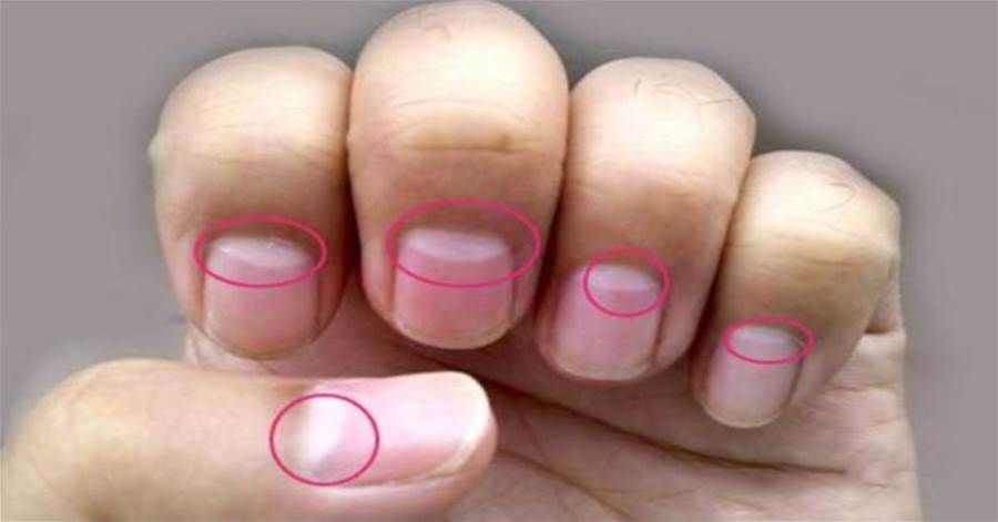 手指的变化是什么病的前兆,体内有癌手指先知是怎么回事