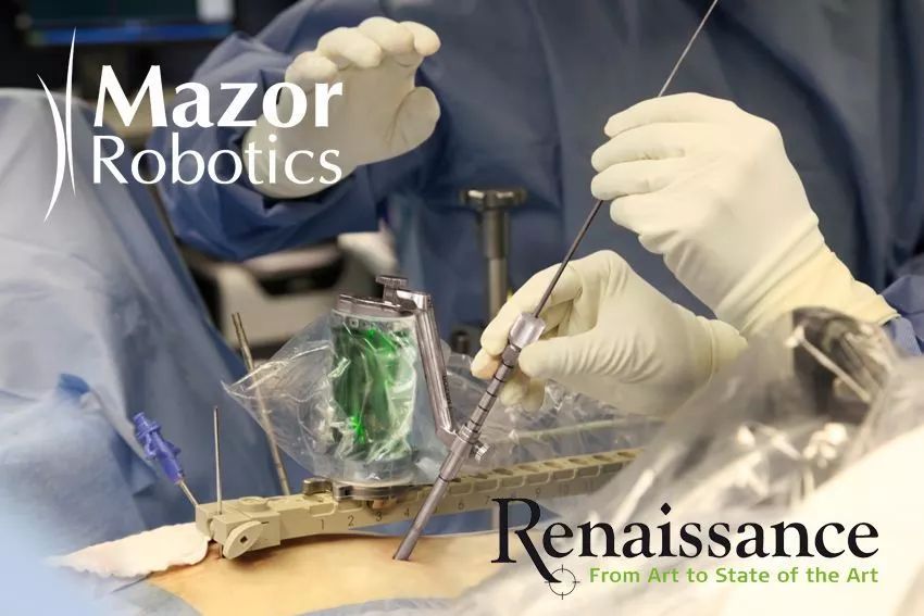 微创外科未来发展趋势,微创外科发展是外科发展的里程碑