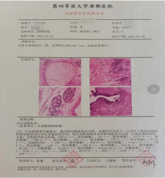 七岁男孩新长出的牙齿都有锯齿,7岁男孩朝上长一颗牙