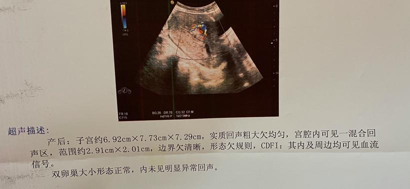 产后13天，血浸满卫生巾后又从裤管流出来