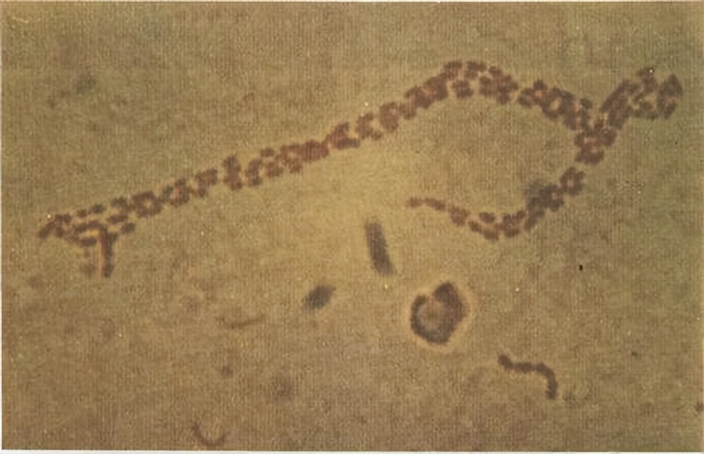 6种通过“性传播”的病你了解几个？建议：私生活不要太“放纵”