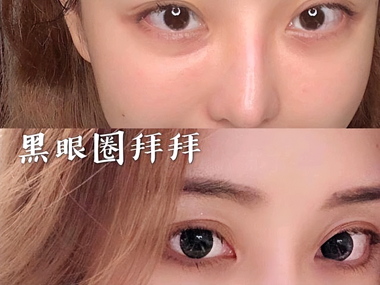 如何消除黑眼圈和眼袋的方法,如何消除黑眼圈