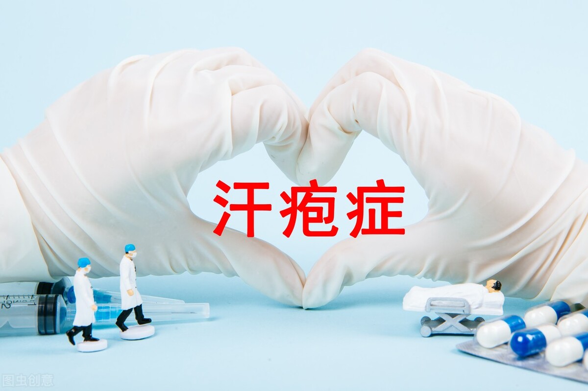 治疗汗疱疹绝对有效的药膏,治疗汗疱疹什么药膏有效