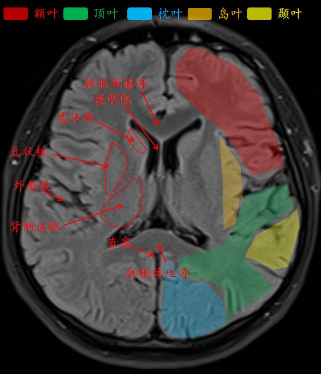 肘关节mri图谱大全,腕关节mri解剖图谱