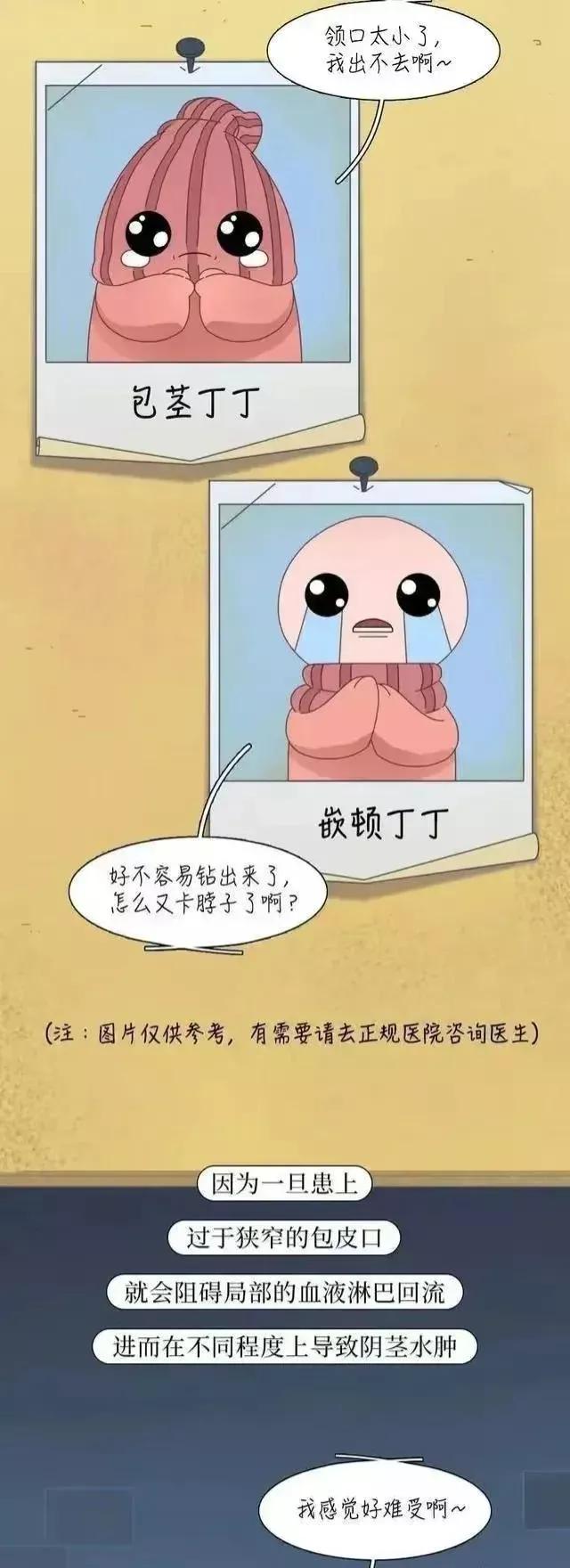 割完包皮的男人,男性割完包皮