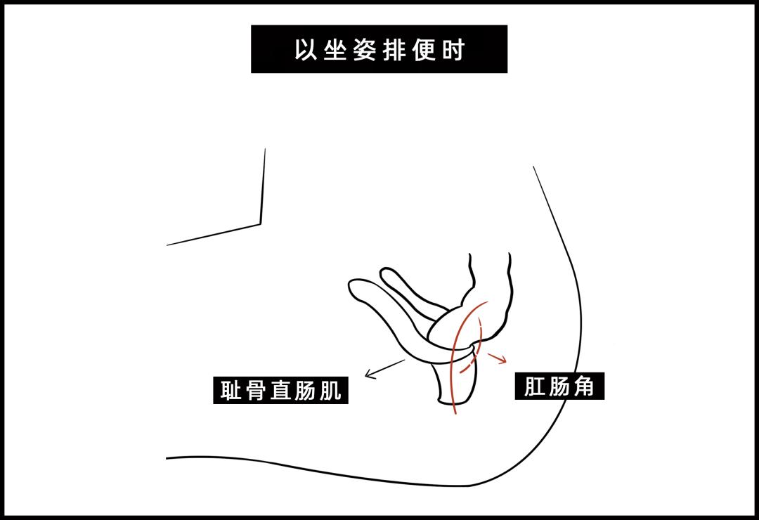 被公厕便池的水溅到,会得性病吗?|8个如厕烦恼全解