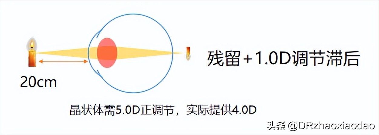 视功能和调节力报告解读