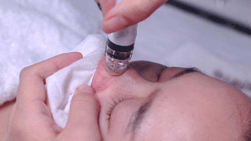 美容院护肤去黑头正常价格,小气泡去黑头美容仪器