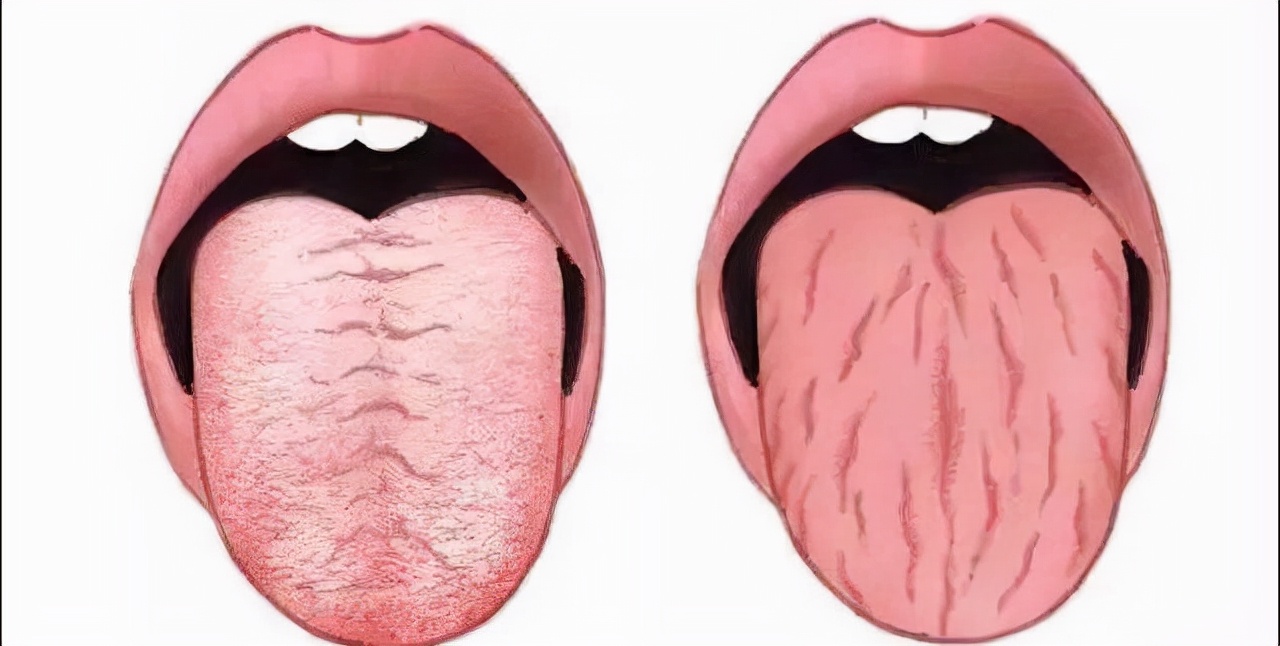 舌诊能准确的看出病症吗,舌诊主要看舌苔吗