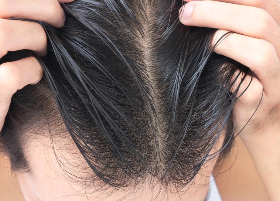 身体缺少黑色素导致白发吃什么好,身体缺什么造成白发