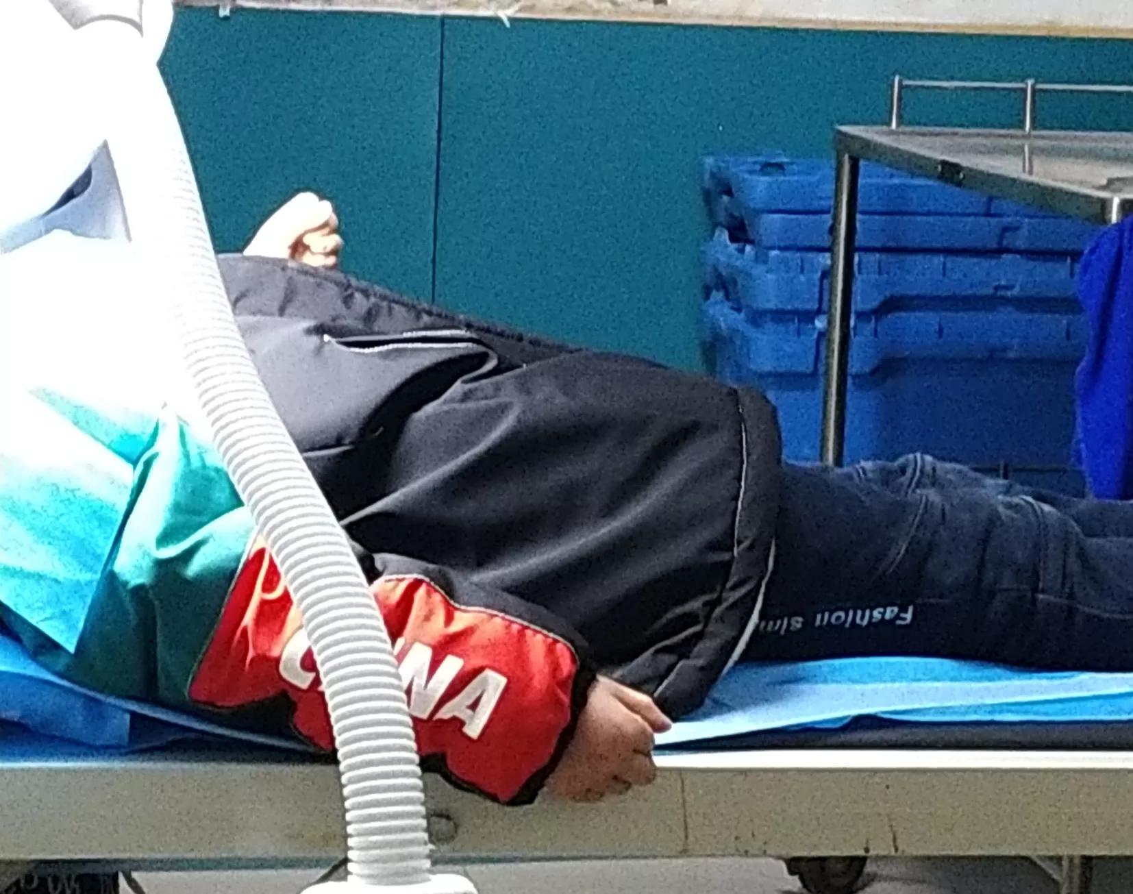 弟弟摔到了医院缝针回来,弟弟摔倒嘴巴摔烂