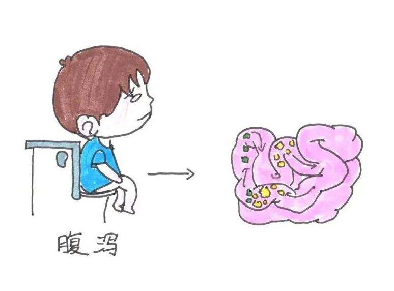 儿童抗生素相关性腹泻指南,宝宝抗生素相关性腹泻怎么处理