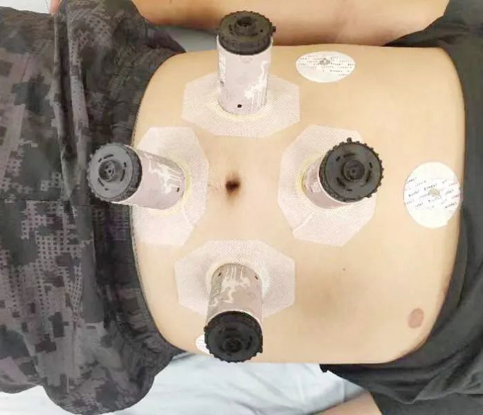 头痛失眠怎么治疗最有效,治失眠头痛有什么方法