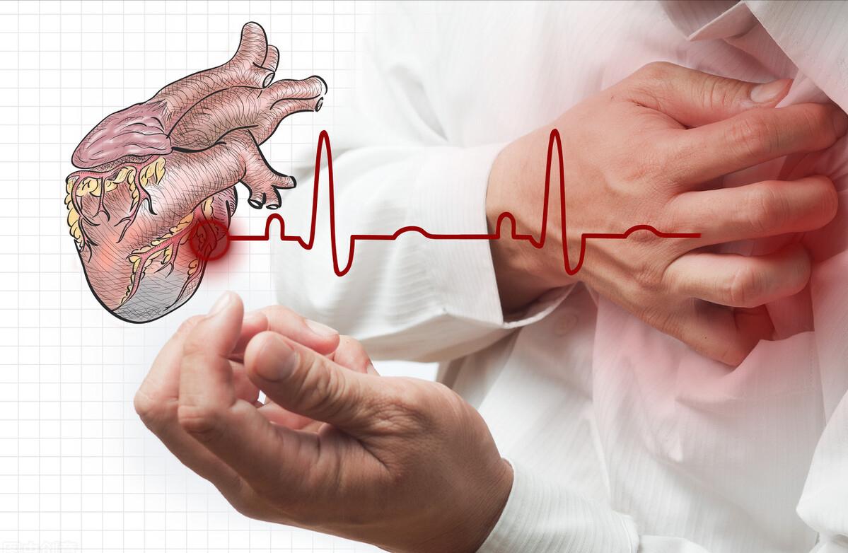 新冠后遗症一年还心律失常,新冠感染后心律失常