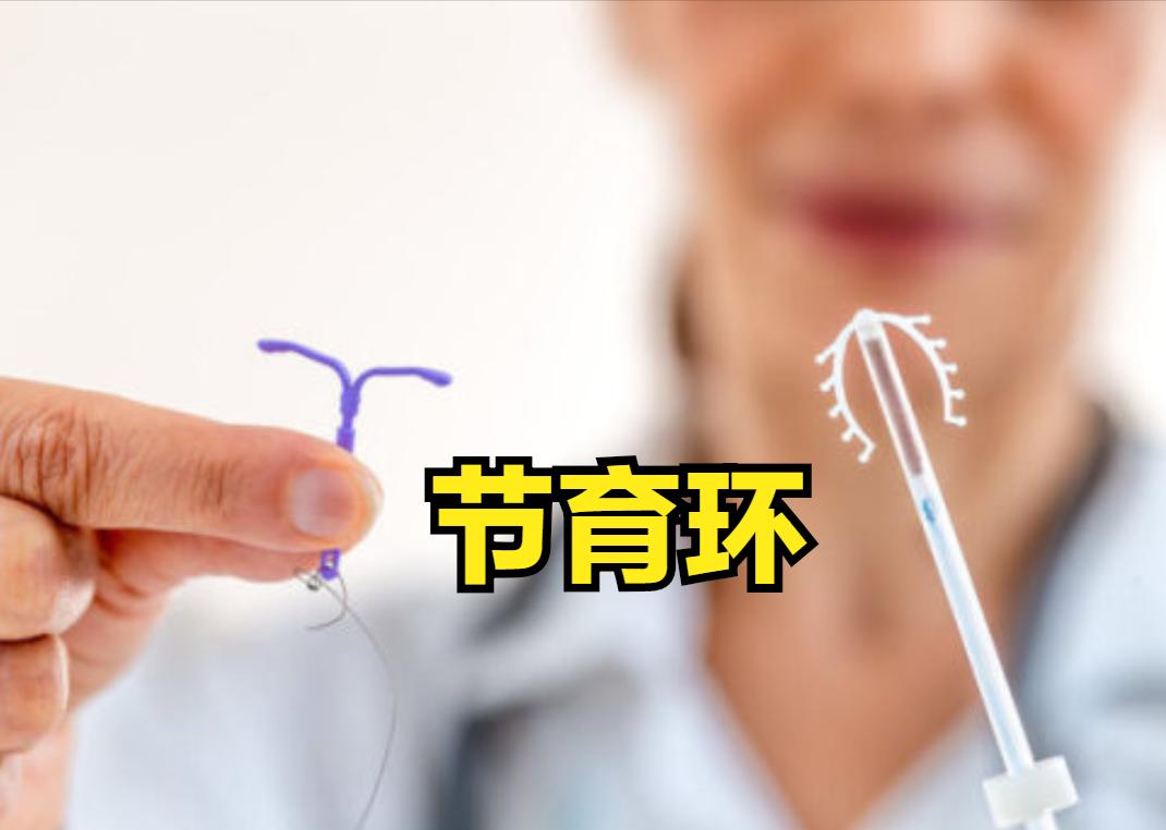 女性取出节育环后多久可以怀孕,节育环在体内有年限吗