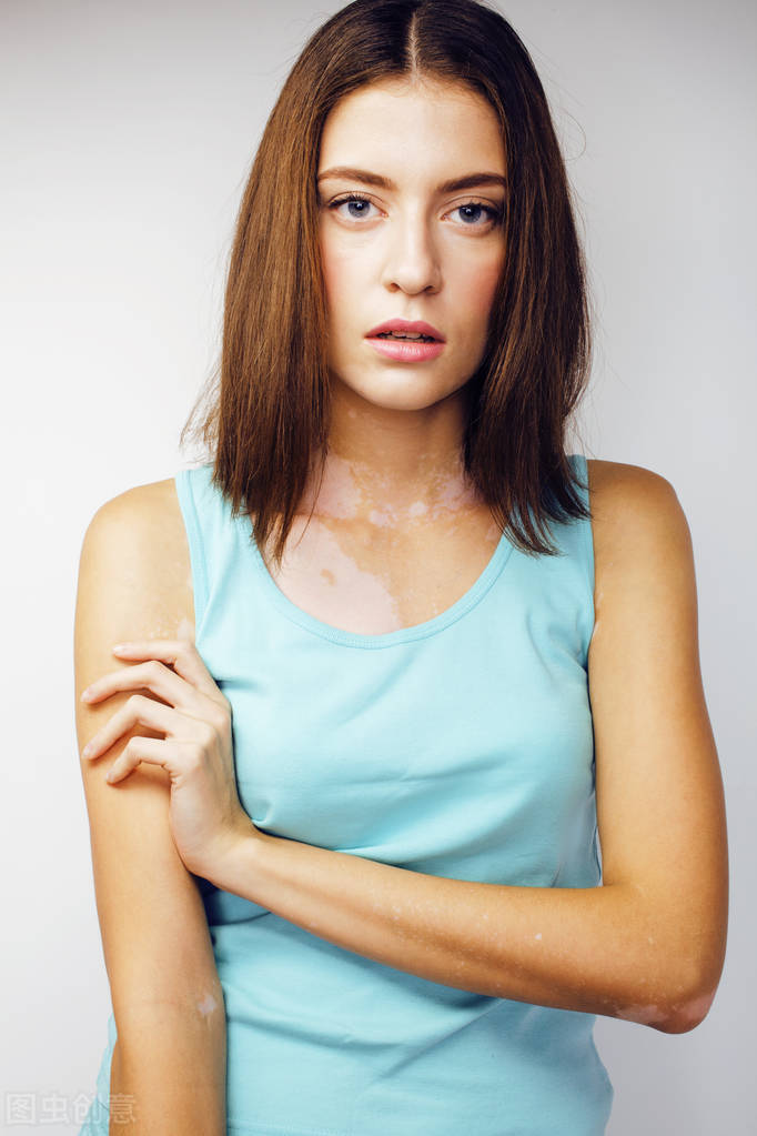 白癜风对情绪有什么影响,如何克服白癜风带来的心理影响