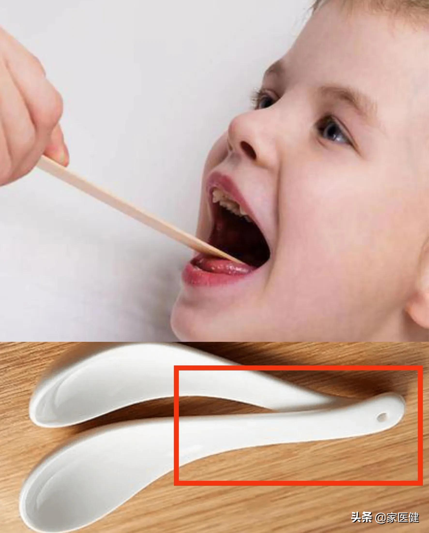 小孩鱼刺卡喉能自愈吗,鱼刺卡喉半年寻医无果