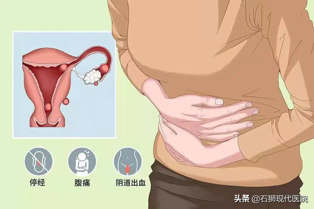 宫外孕危险吗什么症状,宫外孕一般多久会出现危险的症状