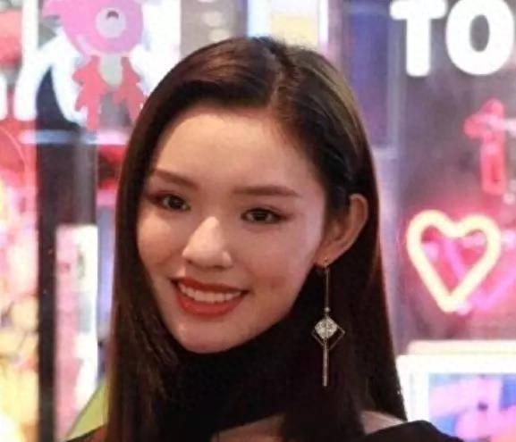 明星烤瓷牙发黑,明星烤瓷牙牙齿磨小后照片