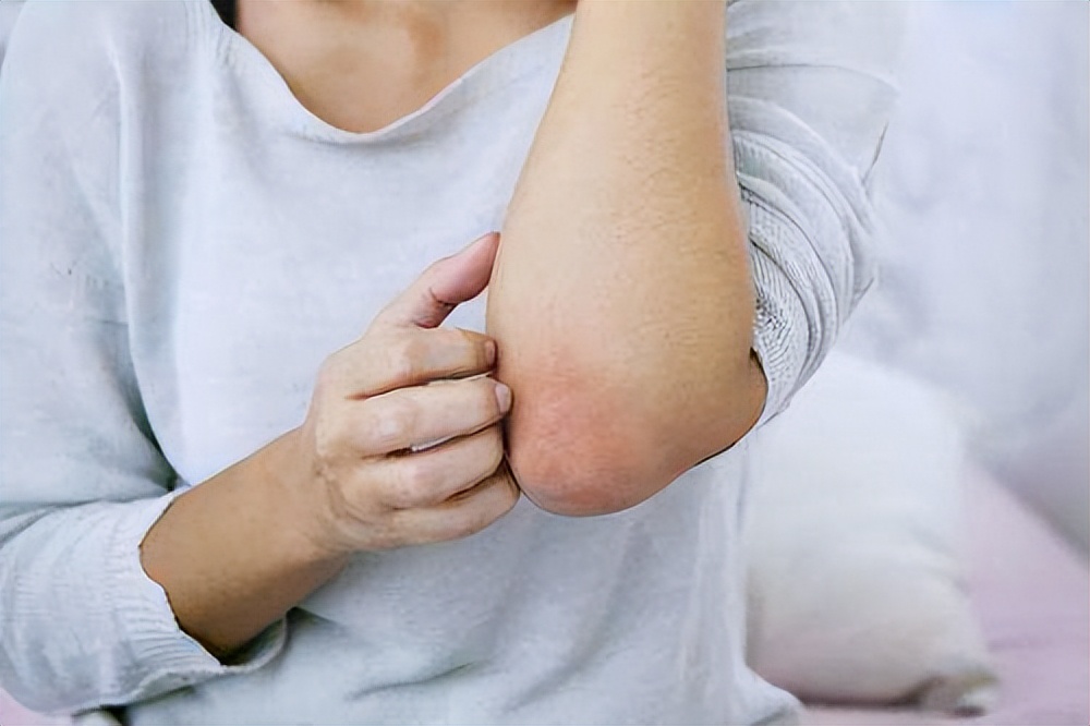 艾滋病皮肤病与其它皮肤有何区别,艾滋病跟乙肝一样吗