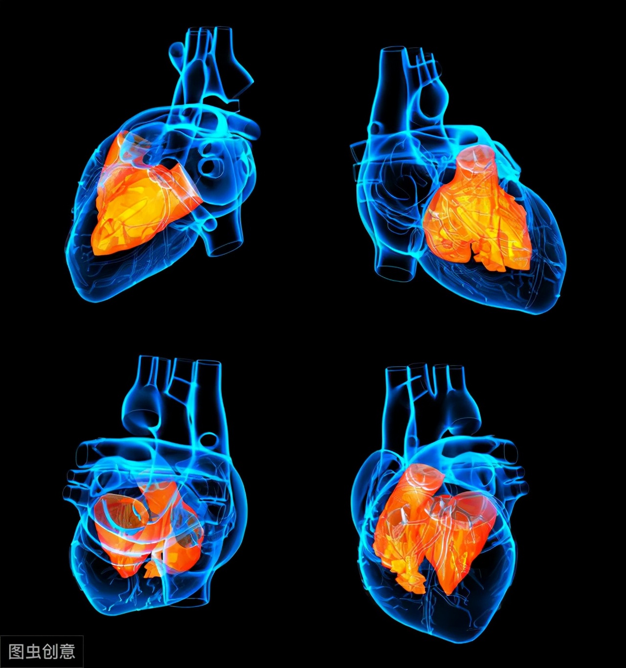 心脏造影是心脏最好的检查吗,什么情况下适合做心脏造影