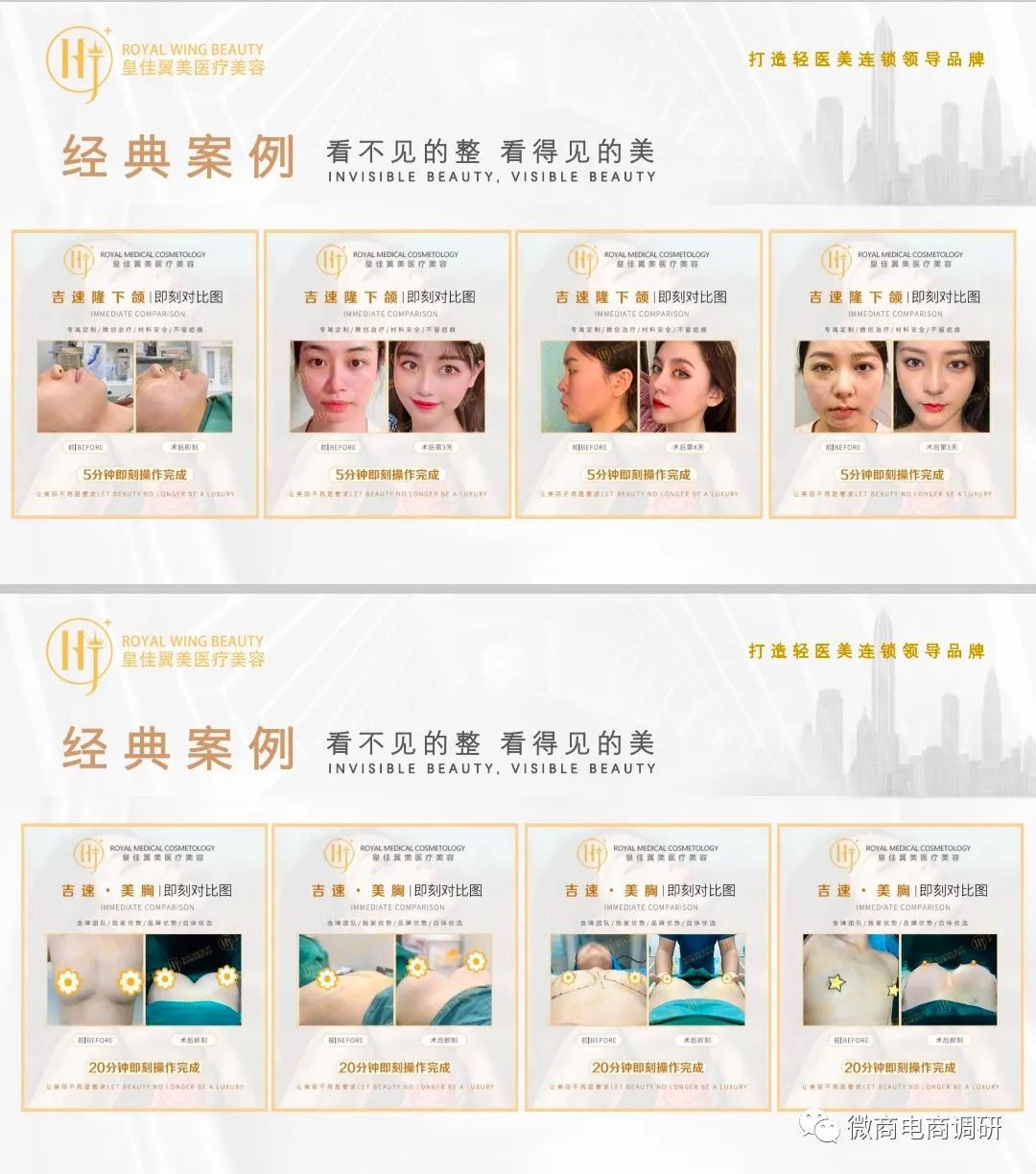 不手术不开刀无痕丰胸,不开刀不手术零风险丰胸