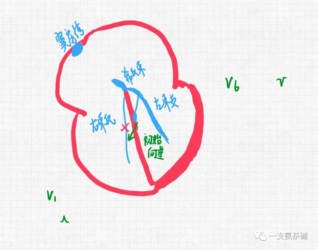 心电图临界异常右束支传导阻滞,心电图十二导和十八导