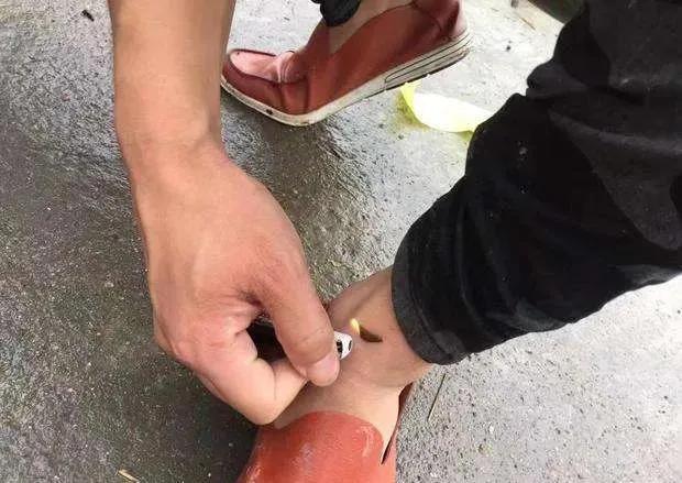 蚂蟥最怕的是食盐能瞬间将它榨干,蚂蟥吸血后会死吗