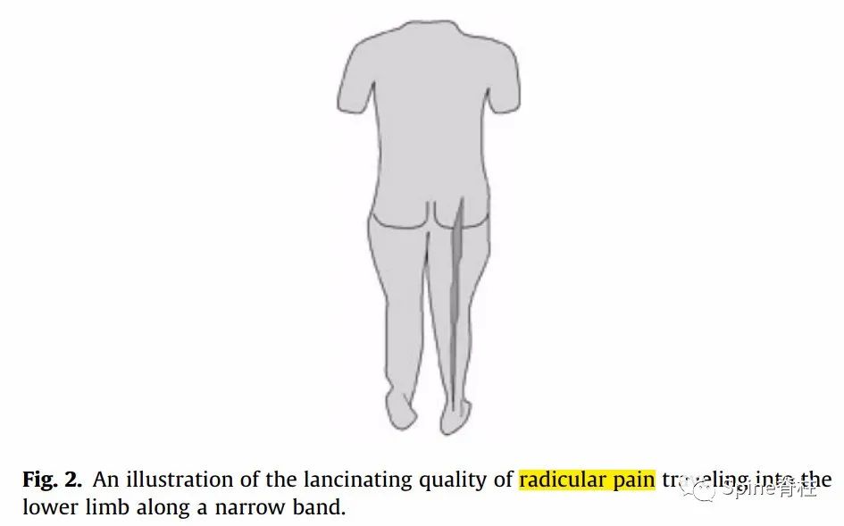 腰椎间盘突出症的治疗方法,腰椎间盘突出症状主要有哪些