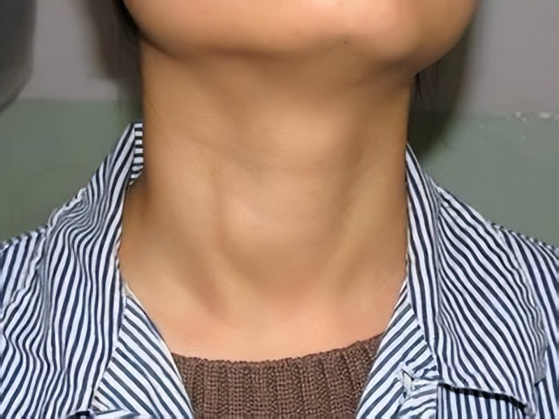 最容易让瘦人变胖的食物,瘦人吃什么食物最好最快