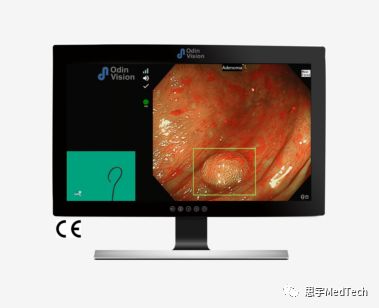 奥林巴斯显微镜被哪里收购了,奥林巴斯2999